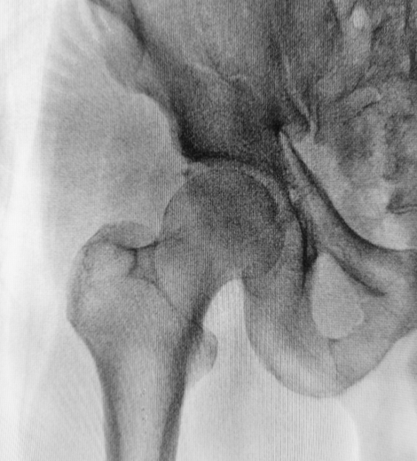 x-ray of human hip bone